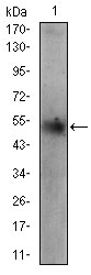 Western blot - Anti Perilipin-2 antibody [2C5H8] (AB181452), expandable thumbnail