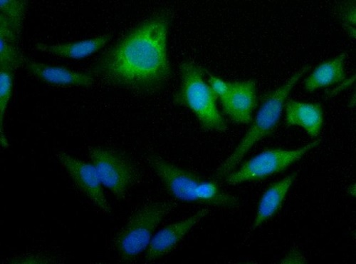 Immunocytochemistry - Anti-Perilipin 2 antibody (AB52356), expandable thumbnail