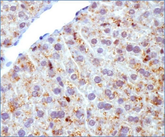 Immunohistochemistry (Formalin/PFA-fixed paraffin-embedded sections) - Anti-Perilipin 2 antibody (AB52356), expandable thumbnail