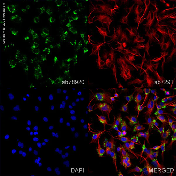 Immunocytochemistry/ Immunofluorescence - Anti-Perilipin 2 antibody (AB78920)