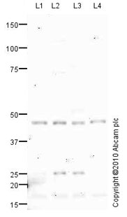 Western blot - Anti-Perilipin 2 antibody (AB78920), expandable thumbnail