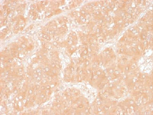 Immunohistochemistry (Formalin/PFA-fixed paraffin-embedded sections) - Anti-Perilipin 2 antibody [ADFP/1366] (AB219299), expandable thumbnail