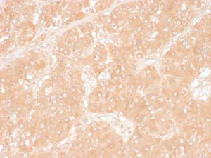 Immunohistochemistry (Formalin/PFA-fixed paraffin-embedded sections) - Anti-Perilipin 2 antibody [ADFP/1366] (AB219299)