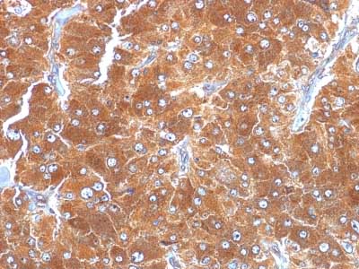Immunohistochemistry (Formalin/PFA-fixed paraffin-embedded sections) - Anti-Perilipin-2 antibody [ADFP/1494] - BSA and Azide free (AB269760), expandable thumbnail