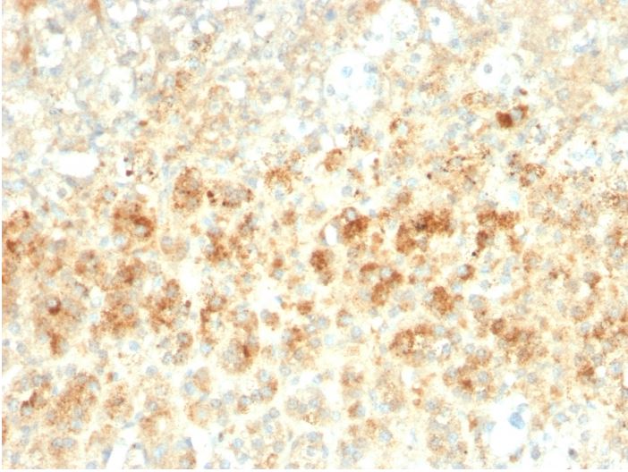 Immunohistochemistry (Formalin/PFA-fixed paraffin-embedded sections) - Anti-Perilipin-2 antibody [ADFP/2755R] (AB270274), expandable thumbnail
