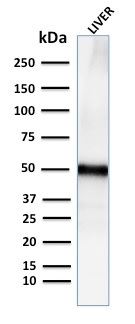 Western blot - Anti-Perilipin-2 antibody [ADFP/2755R] (AB270274), expandable thumbnail