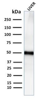 Western blot - Anti-Perilipin-2 antibody [ADFP/2755R] (AB270274)