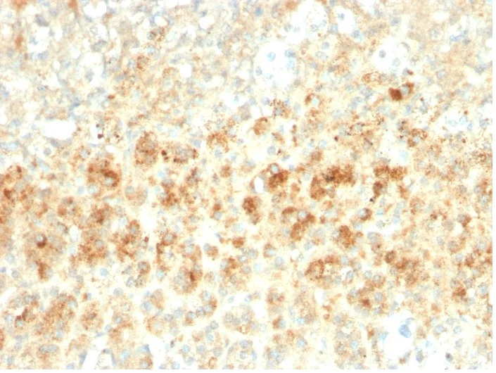 Immunohistochemistry (Formalin/PFA-fixed paraffin-embedded sections) - Anti-Perilipin-2 antibody [ADFP/2755R] - BSA and Azide free (AB270306)