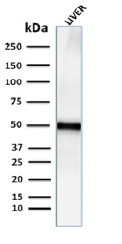 Western blot - Anti-Perilipin-2 antibody [ADFP/2755R] - BSA and Azide free (AB270306), expandable thumbnail