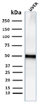 Western blot - Anti-Perilipin-2 antibody [ADFP/2755R] - BSA and Azide free (AB270306)