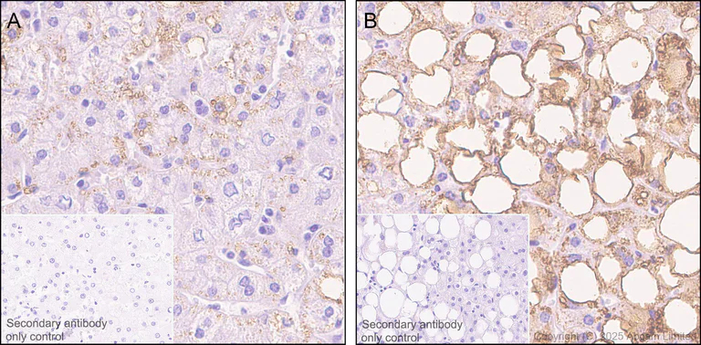 Immunohistochemistry (Formalin/PFA-fixed paraffin-embedded sections) - Anti-Perilipin-2 antibody [EPR28638-122] (AB324643)