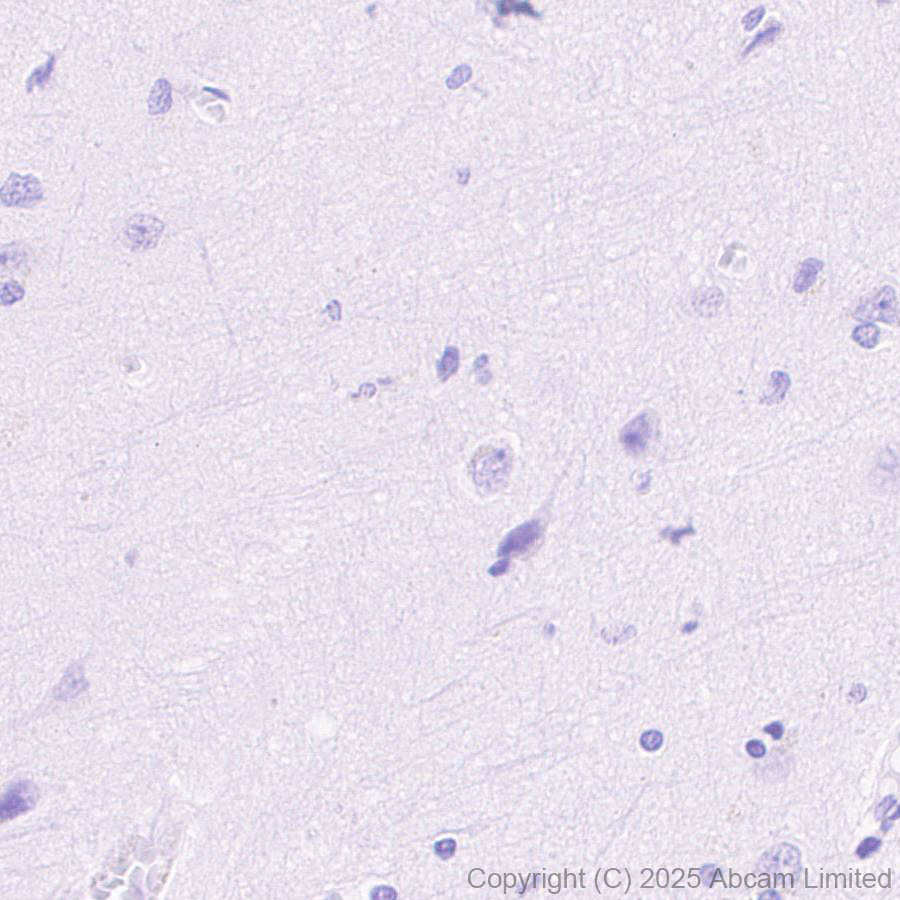 Immunohistochemistry (Formalin/PFA-fixed paraffin-embedded sections) - Anti-Perilipin-2 antibody [EPR28638-122] (AB324643)