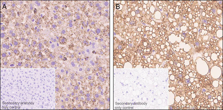 Immunohistochemistry (Formalin/PFA-fixed paraffin-embedded sections) - Anti-Perilipin-2 antibody [EPR28638-122] - BSA and Azide free (AB324644)