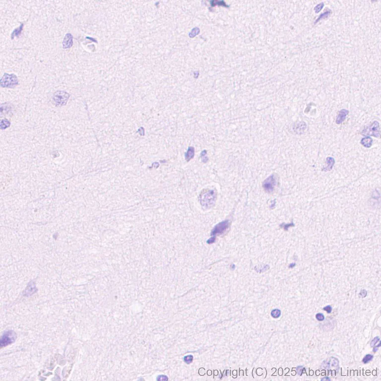 Immunohistochemistry (Formalin/PFA-fixed paraffin-embedded sections) - Anti-Perilipin-2 antibody [EPR28638-122] - BSA and Azide free (AB324644)