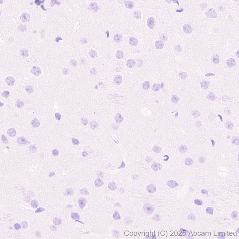 Immunohistochemistry (Formalin/PFA-fixed paraffin-embedded sections) - Anti-Perilipin-2 antibody [EPR28638-122] - BSA and Azide free (AB324644)