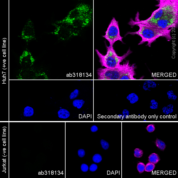 Immunocytochemistry/ Immunofluorescence - Anti-Perilipin-2 antibody [EPR28638-74] - BSA and Azide free (AB318135), expandable thumbnail