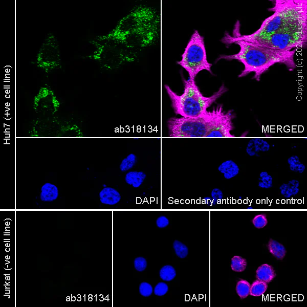 Immunocytochemistry/ Immunofluorescence - Anti-Perilipin-2 antibody [EPR28638-74] - BSA and Azide free (AB318135)