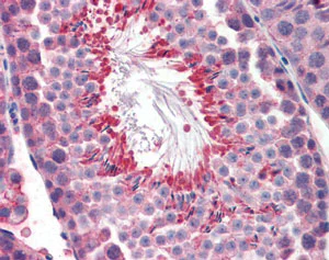 Immunohistochemistry (Formalin/PFA-fixed paraffin-embedded sections) - Anti-Perilipin 3/TIP47 antibody (AB118605)