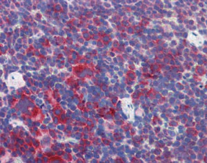 Immunohistochemistry (Formalin/PFA-fixed paraffin-embedded sections) - Anti-Perilipin 3/TIP47 antibody (AB118605)