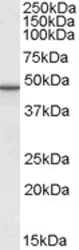 Western blot - Anti-Perilipin 3/TIP47 antibody (AB118605)