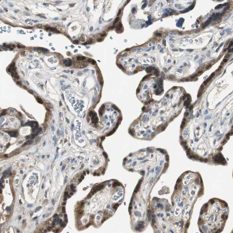 Immunohistochemistry (Formalin/PFA-fixed paraffin-embedded sections) - Anti-Perilipin 3/TIP47 antibody (AB224344)