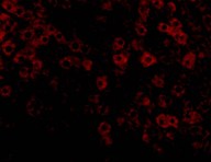 Immunocytochemistry/ Immunofluorescence - Anti-Perilipin 3/TIP47 antibody (AB47638)