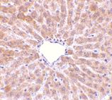 Immunohistochemistry (Formalin/PFA-fixed paraffin-embedded sections) - Anti-Perilipin 3/TIP47 antibody (AB47638), expandable thumbnail