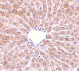 Immunohistochemistry (Formalin/PFA-fixed paraffin-embedded sections) - Anti-Perilipin 3/TIP47 antibody (AB47638)