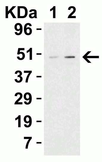 Western blot - Anti-Perilipin 3/TIP47 antibody (AB47638), expandable thumbnail