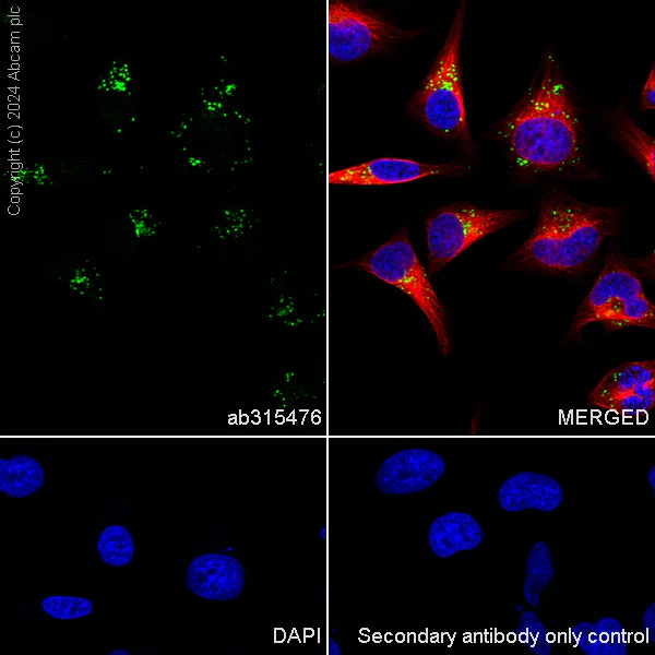 Immunocytochemistry/ Immunofluorescence - Anti-Perilipin 3/TIP47 antibody [EPR28801-93] - BSA and Azide free (AB315477)