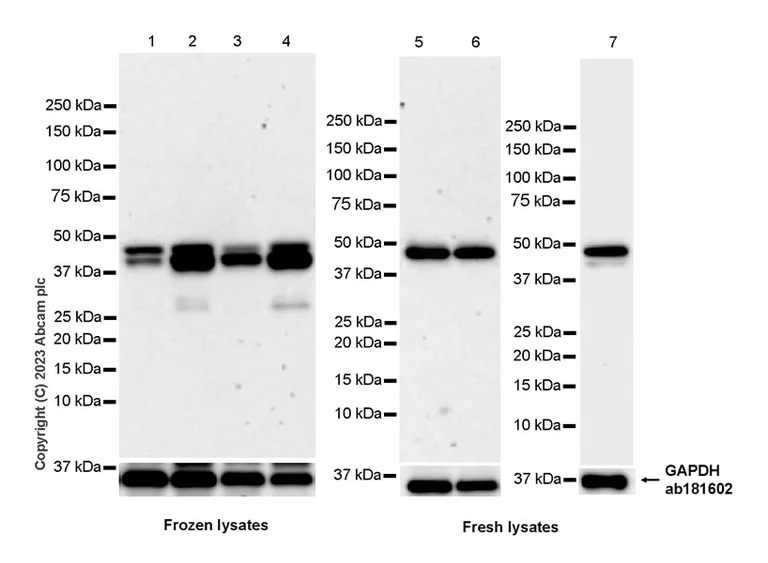 Western blot - Anti-Perilipin 3/TIP47 antibody [EPR28801-93] - BSA and Azide free (AB315477)