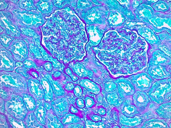 Immunohistochemistry (Formalin/PFA-fixed paraffin-embedded sections) - Periodic Acid Schiff (PAS) Stain Kit (Mucin Stain) (AB150680)