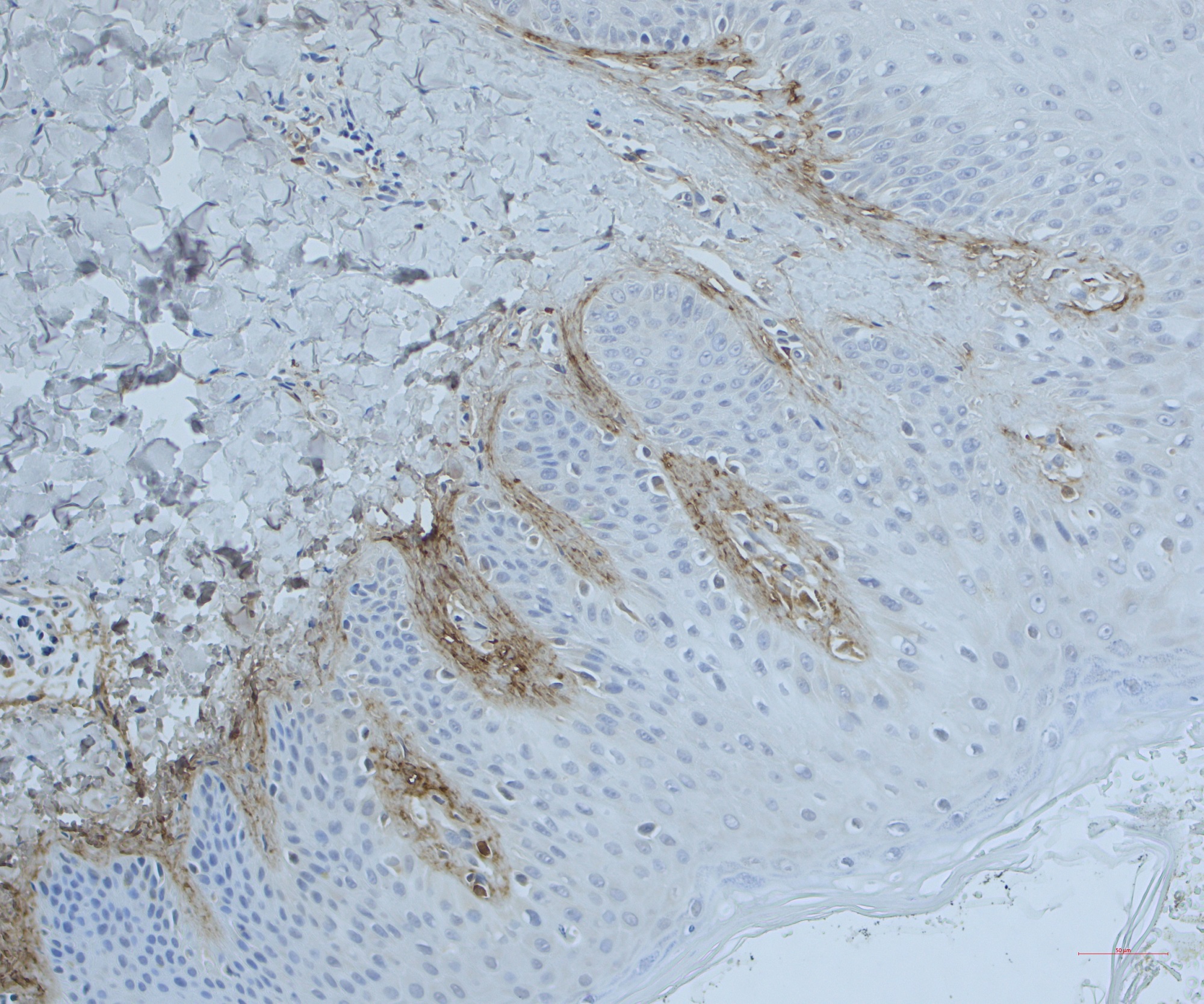 Immunohistochemistry (Formalin/PFA-fixed paraffin-embedded sections) - Anti-Periostin antibody (AB14041), expandable thumbnail