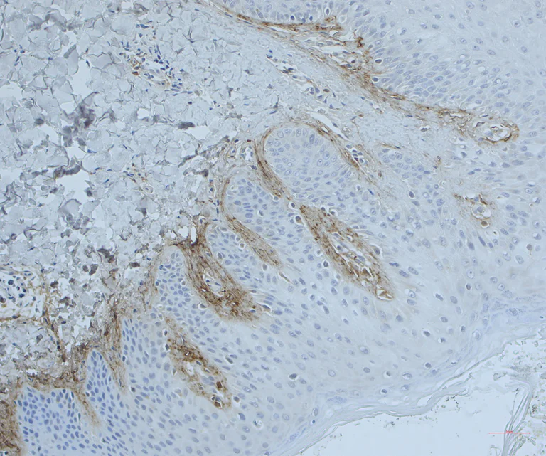 Immunohistochemistry (Formalin/PFA-fixed paraffin-embedded sections) - Anti-Periostin antibody (AB14041)