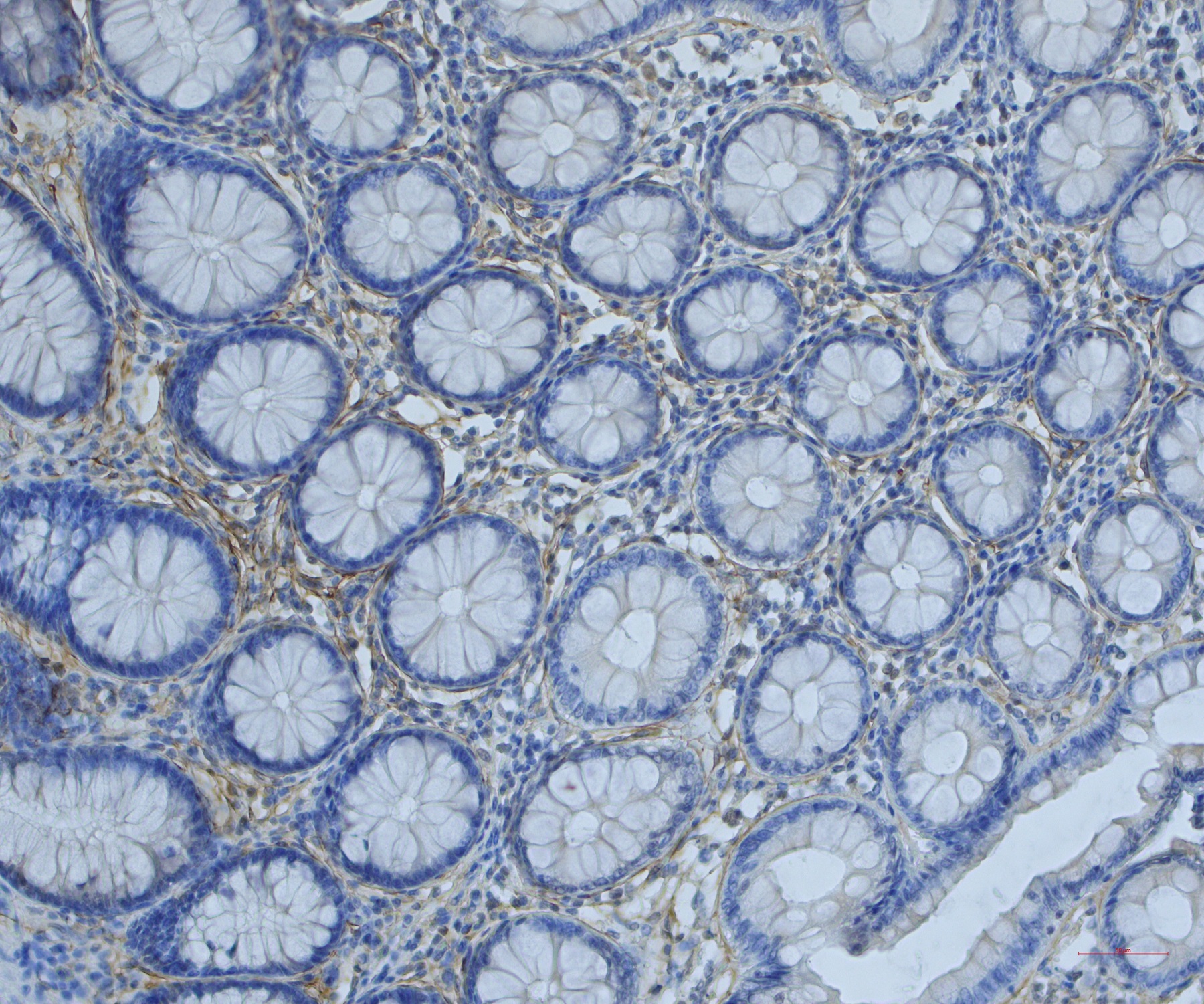 Immunohistochemistry (Formalin/PFA-fixed paraffin-embedded sections) - Anti-Periostin antibody (AB14041), expandable thumbnail