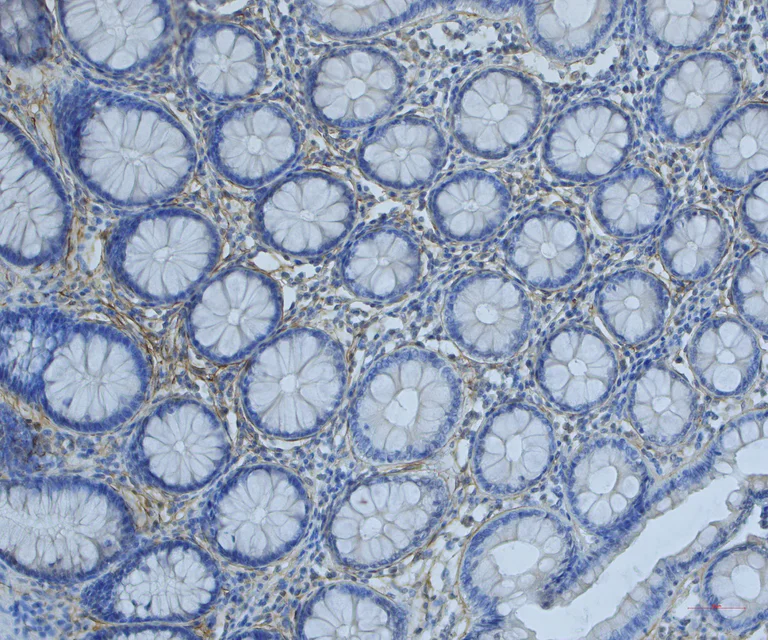 Immunohistochemistry (Formalin/PFA-fixed paraffin-embedded sections) - Anti-Periostin antibody (AB14041)
