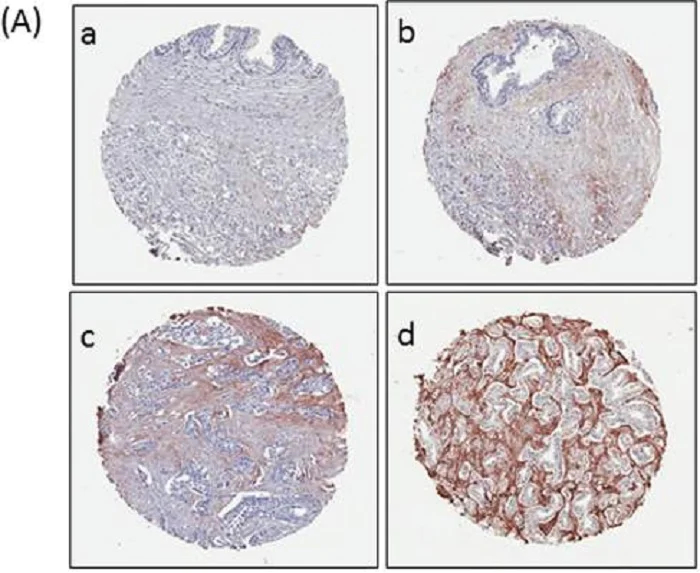 Immunohistochemistry (Formalin/PFA-fixed paraffin-embedded sections) - Anti-Periostin antibody (AB14041)