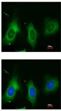 Immunocytochemistry/ Immunofluorescence - Anti-Periostin antibody (AB152099)