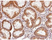 Immunohistochemistry (Formalin/PFA-fixed paraffin-embedded sections) - Anti-Periostin antibody (AB152099), expandable thumbnail
