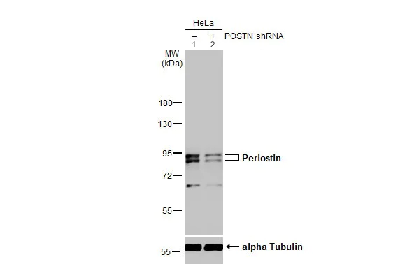 Western blot - Anti-Periostin antibody (AB152099)