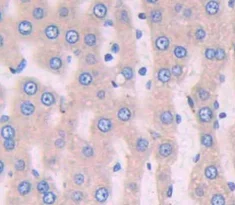 Immunohistochemistry (Formalin/PFA-fixed paraffin-embedded sections) - Anti-Periostin antibody (AB231130)
