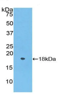 Western blot - Anti-Periostin antibody (AB231130)