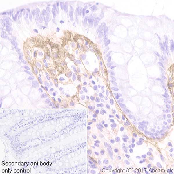 Immunohistochemistry (Formalin/PFA-fixed paraffin-embedded sections) - Anti-Periostin antibody [EPR19934] (AB219056)