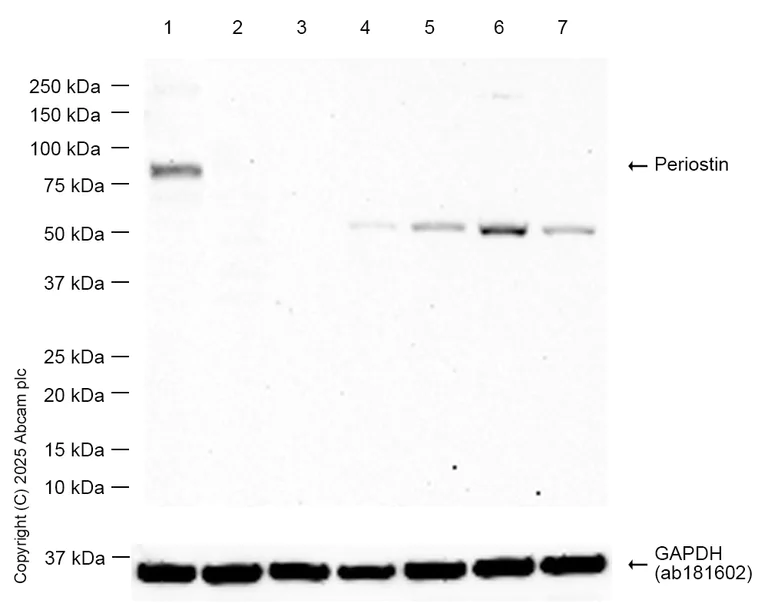 Western blot - Anti-Periostin antibody [EPR19934] (AB219056)