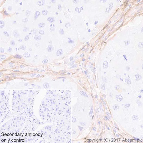 Immunohistochemistry (Formalin/PFA-fixed paraffin-embedded sections) - Anti-Periostin antibody [EPR19934] - BSA and Azide free (AB223194)