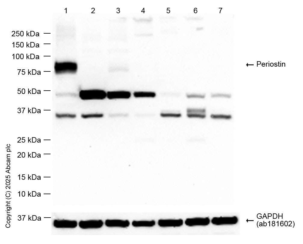 Western blot - Anti-Periostin antibody [EPR19936] (AB219057)