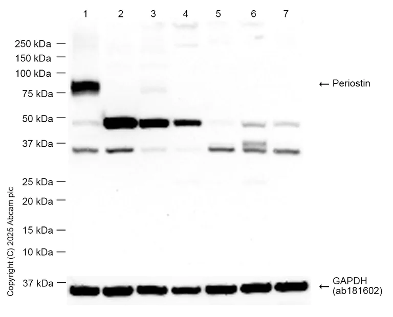 Western blot - Anti-Periostin antibody [EPR19936] - BSA and Azide free (AB251563)