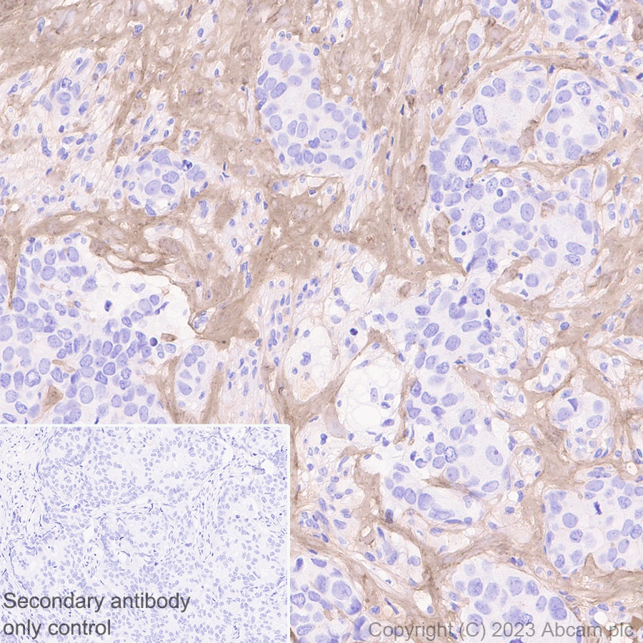 Immunohistochemistry (Formalin/PFA-fixed paraffin-embedded sections) - Anti-Periostin antibody [EPR20806] (ab215199), expandable thumbnail
