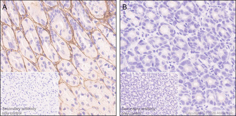 Immunohistochemistry (Formalin/PFA-fixed paraffin-embedded sections) - Anti-Periostin antibody [EPR20806] (AB215199)