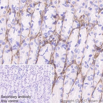 Immunohistochemistry (Formalin/PFA-fixed paraffin-embedded sections) - Anti-Periostin antibody [EPR20806] (AB215199), expandable thumbnail